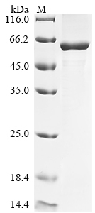 Human CTSD protein