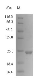 Human CXCL1 protein