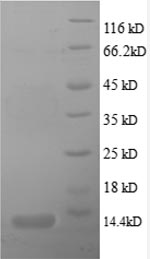 Human CXCL5 protein