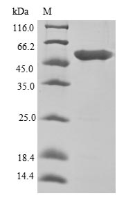 Human EEF1A1 protein