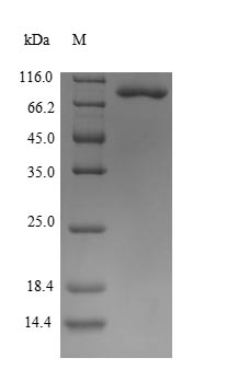 Human ENO1 protein