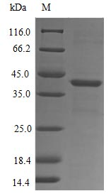 Human FPR1 protein