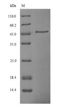 Human Ferritin protein