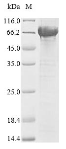 Human GBA protein