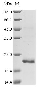 Human GCGR protein