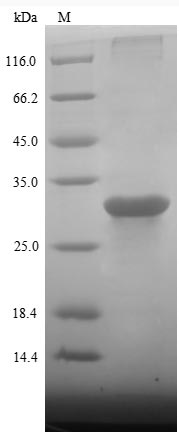 Porcine GHR protein