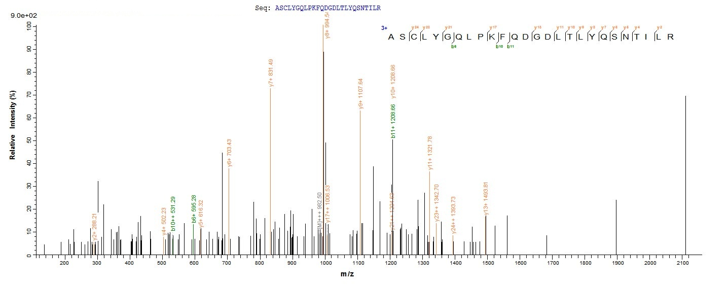 Human GSTP1 protein