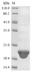 Human HIST1H3A protein