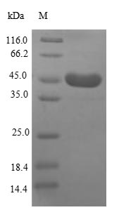 Human HSP90AA1 protein