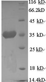 Human HSPA5 protein