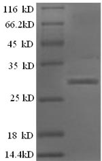 Human IAPP protein