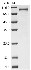Human IKBKB protein