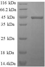 Human IL1B protein