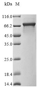 Mouse Irak3 protein