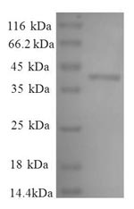Human LDHA protein