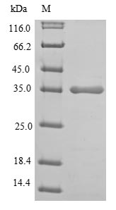 Human LDHA protein