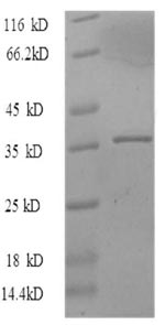 Human MKI67 protein