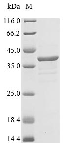 Human MPZ protein