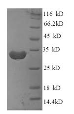 Mouse Ms4a1 protein