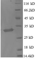 Human MT1X protein