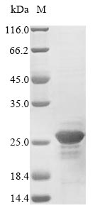 Human GRIN2B protein