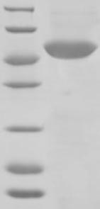 Human Glucocorticoid Receptor protein