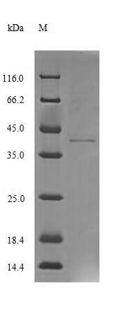Human PCBD1 protein