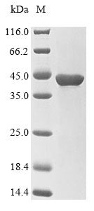 Human PPP1CC protein