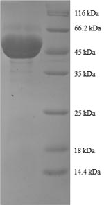 Human PRDX1 protein