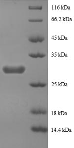 Human PYY protein