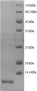 Human PYY protein