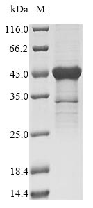 Human RPS3 protein