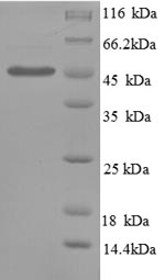 Human PAI-1 protein