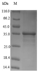 Human SMARCA4 protein
