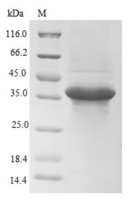 Human TAGLN2 protein