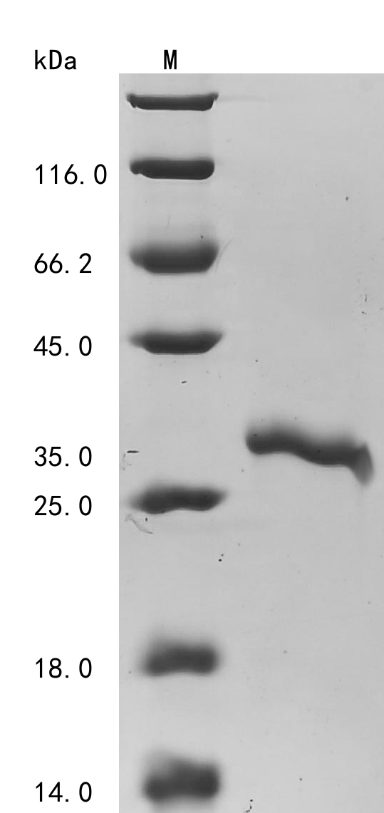 Human TAGLN2 protein