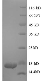 Human TGF beta 1 protein