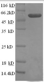 Human TNFSF10 protein