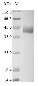 Rabbit Tropomyosin protein