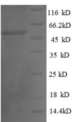 Human TPMT protein