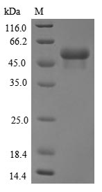 Human TRIM21 protein
