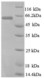 Human TROVE2 protein