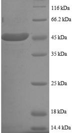 Human UBE2I protein