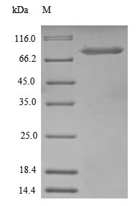 Human UBTF protein