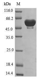 Human WARS protein