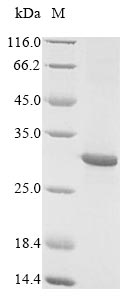 Fish Oncorhynchus keta L-rhamnose-binding lectin CSL3 protein