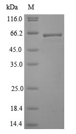 Virus Lassa virus Nucleoprotein(N) protein