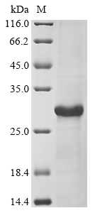 Virus HN protein
