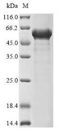 Coronavirus N protein