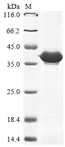 Virus PS/HR protein
